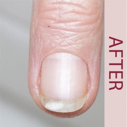 ProNails - Diamond Grinder Bit - Dual Rotating