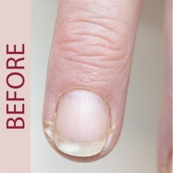 ProNails - Diamond Grinder Bit - Dual Rotating