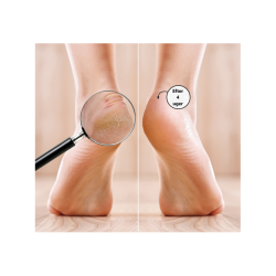 Cracked Heel Foam - Skum mod hlerevner 125 ml