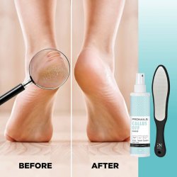 Callus Off - Hrd Hud Opbldning 180 ml