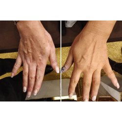 Curasano - Sprayfoundation Express - Krops Make-Up 125 ml / Golden Beach N�10